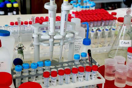 Où est l'analyse de l'eau du puits Équipement de recherche sur la qualité de l'eau